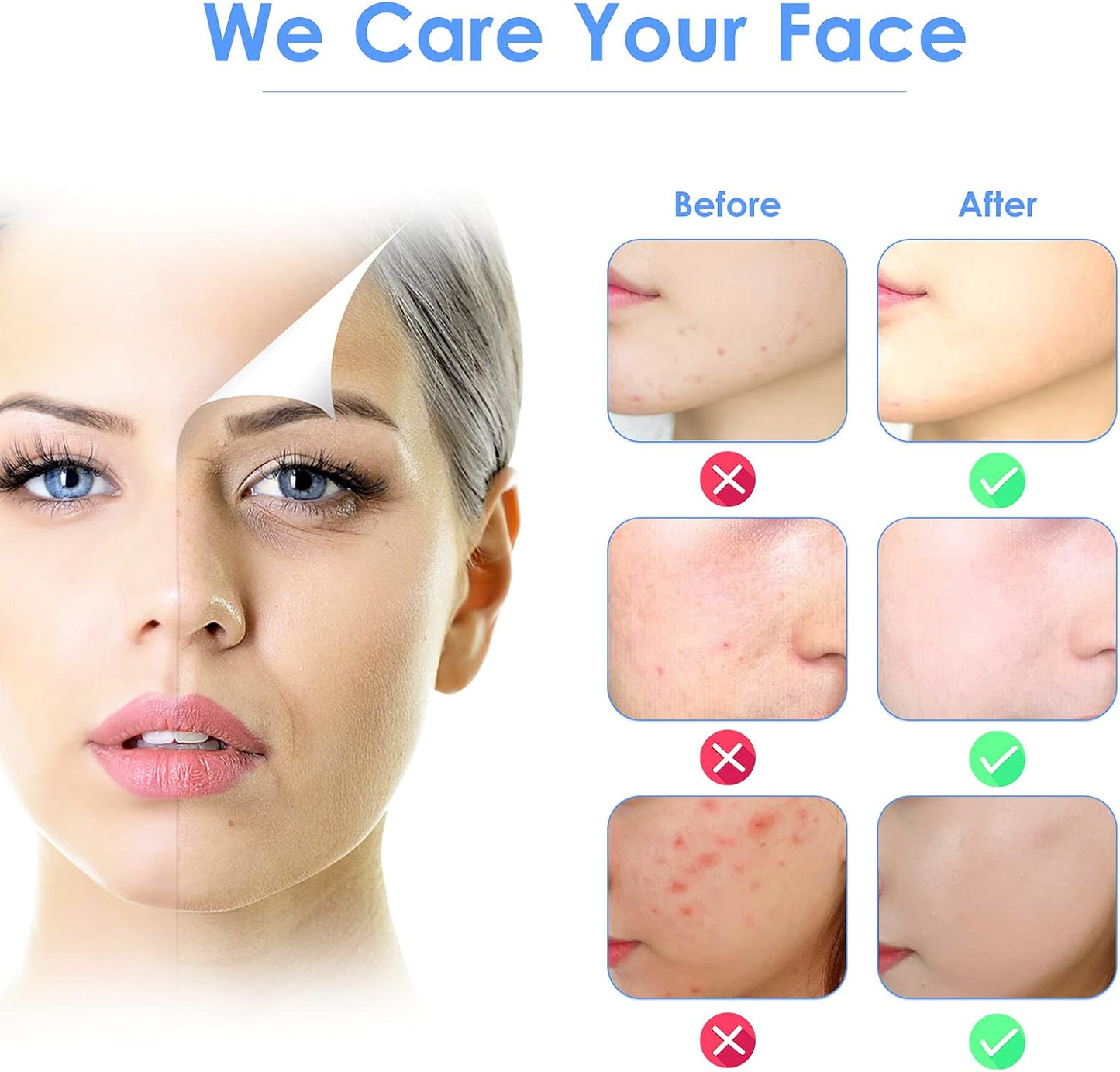 Radiant Skin Ultrasonic Scrubber™