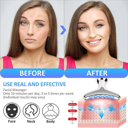 RadiantLift™ Facial Massager